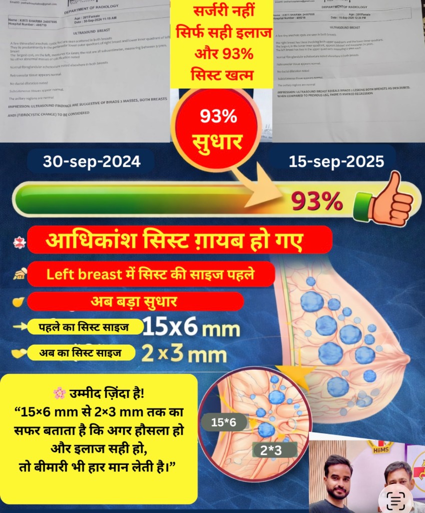 Breast cyst success story poster